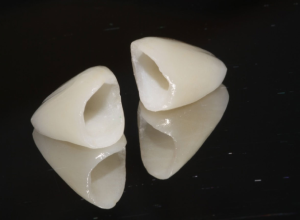 zirconia crown