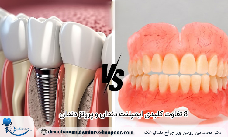 تفاوت کلیدی ایمپلنت دندان و پروتز دندان