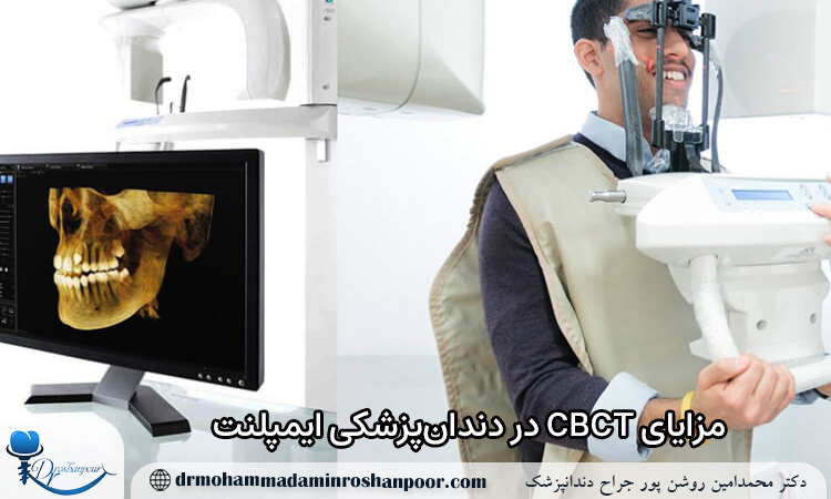 مزایای CBCT در دندان‌پزشکی ایمپلنت