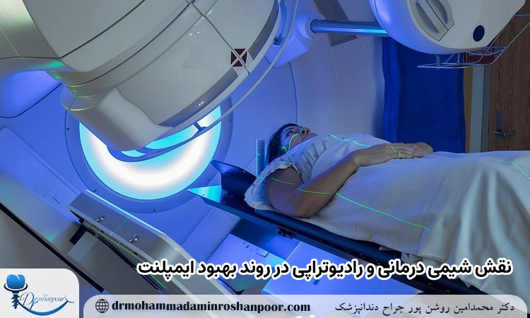 نقش شیمی درمانی و رادیوتراپی در روند بهبود ایمپلنت