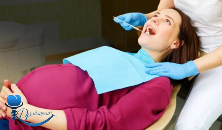 ایمپلنت دندان در بارداری: انجام بدهیم یا نه؟