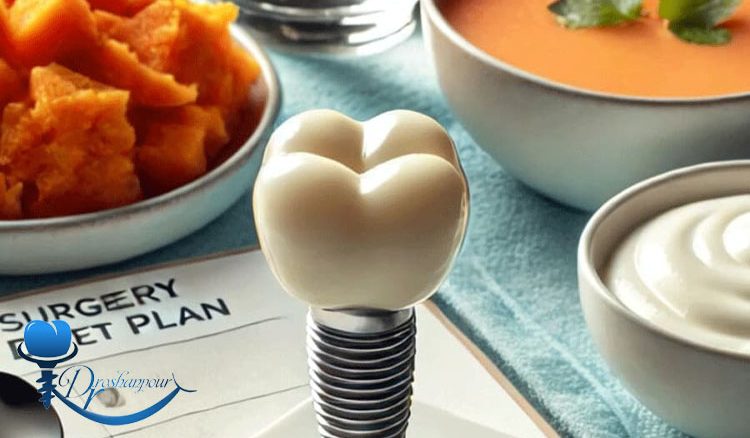 تأثیر تغذیه بر موفقیت ایمپلنت دندان