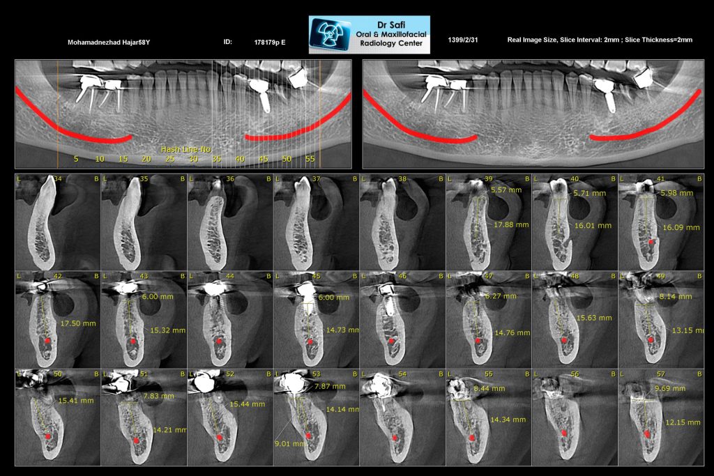 dental cbct