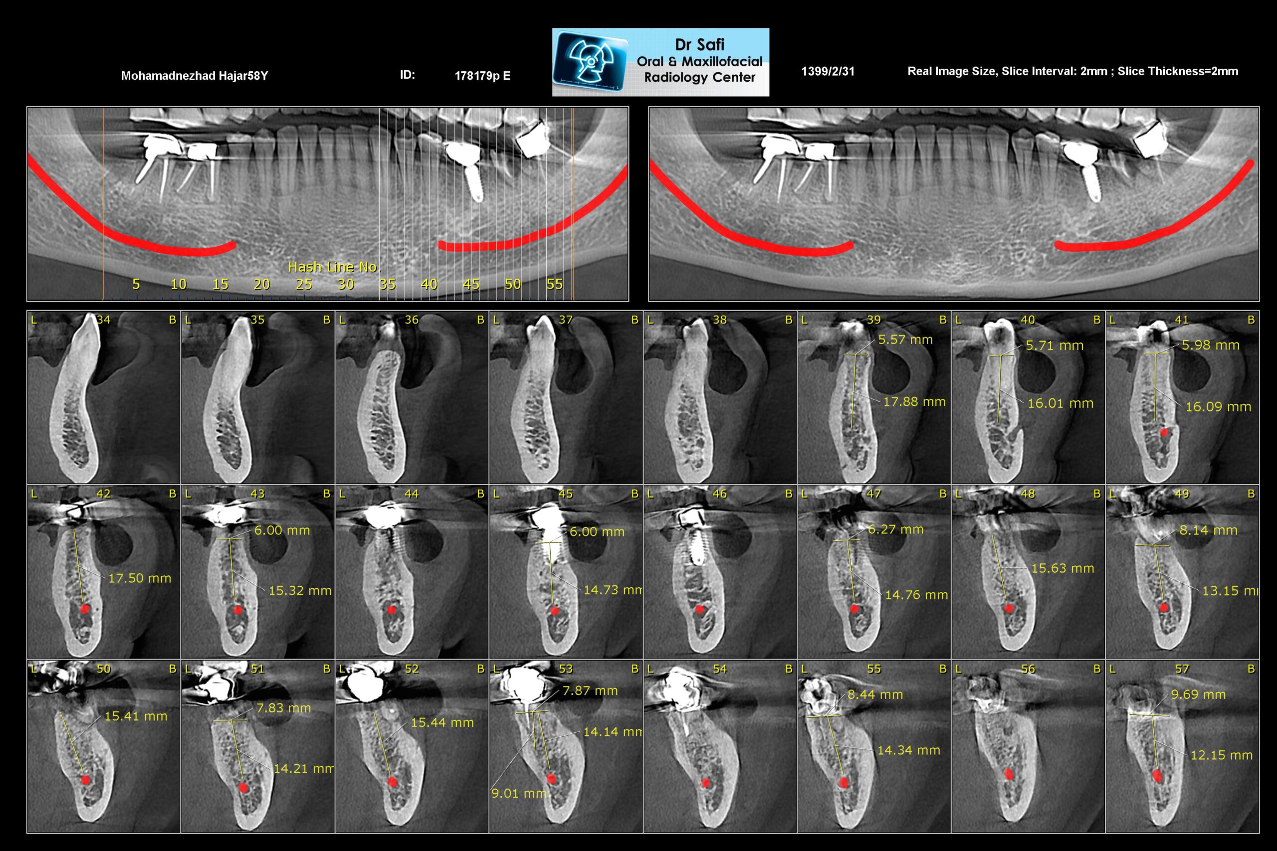 dental cbct
