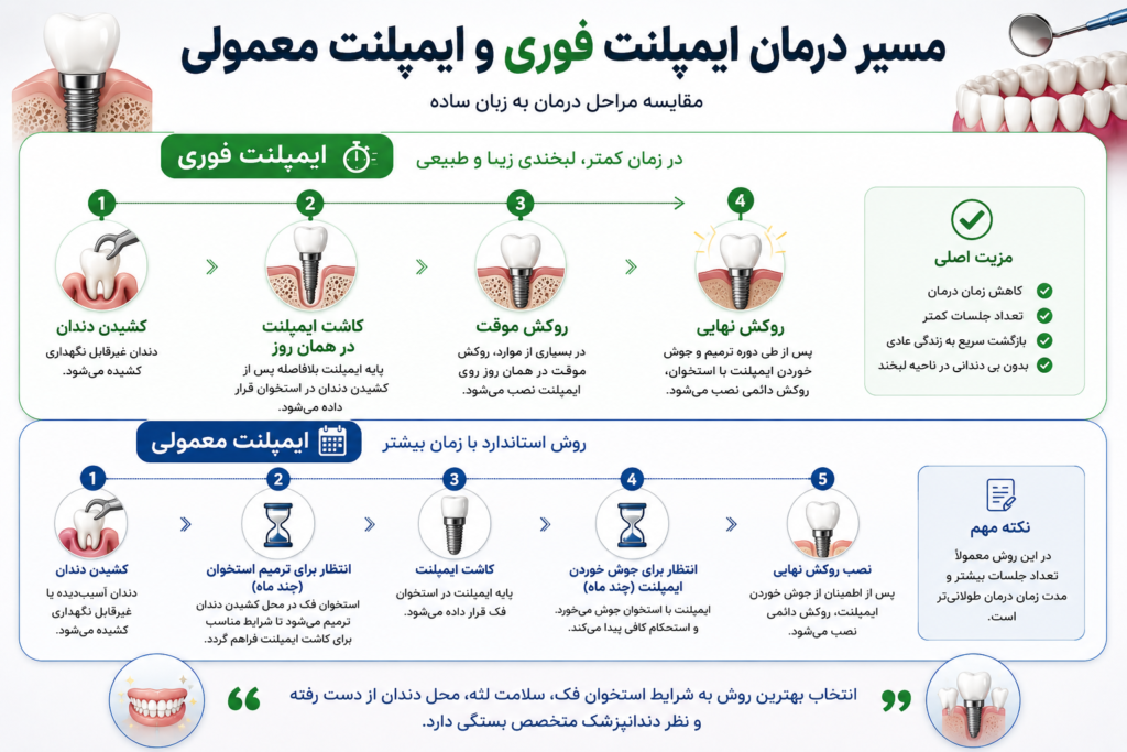 مراحل ایمپلنت فوری