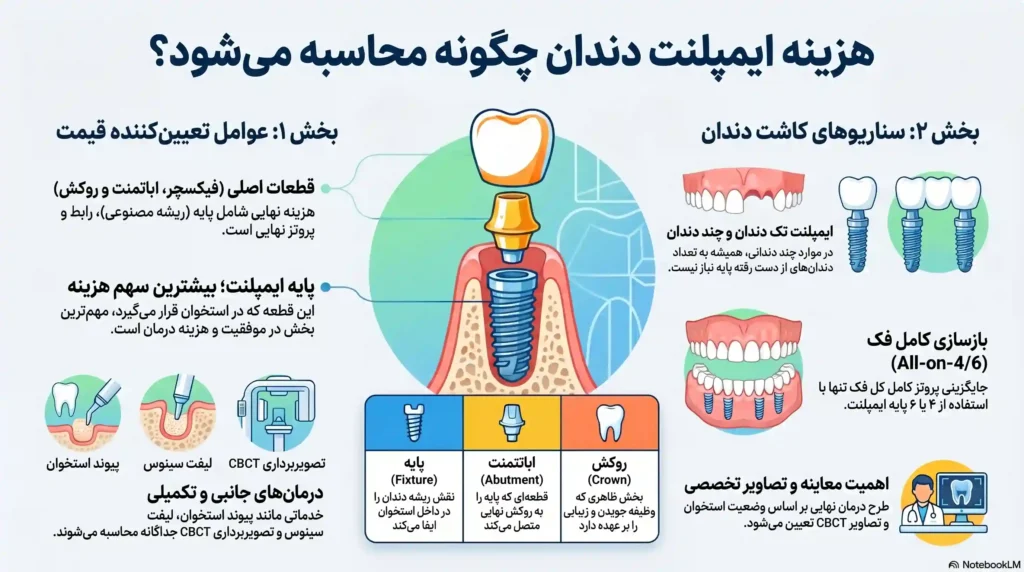 قیمت ایمپلنت دندان در اصفهان