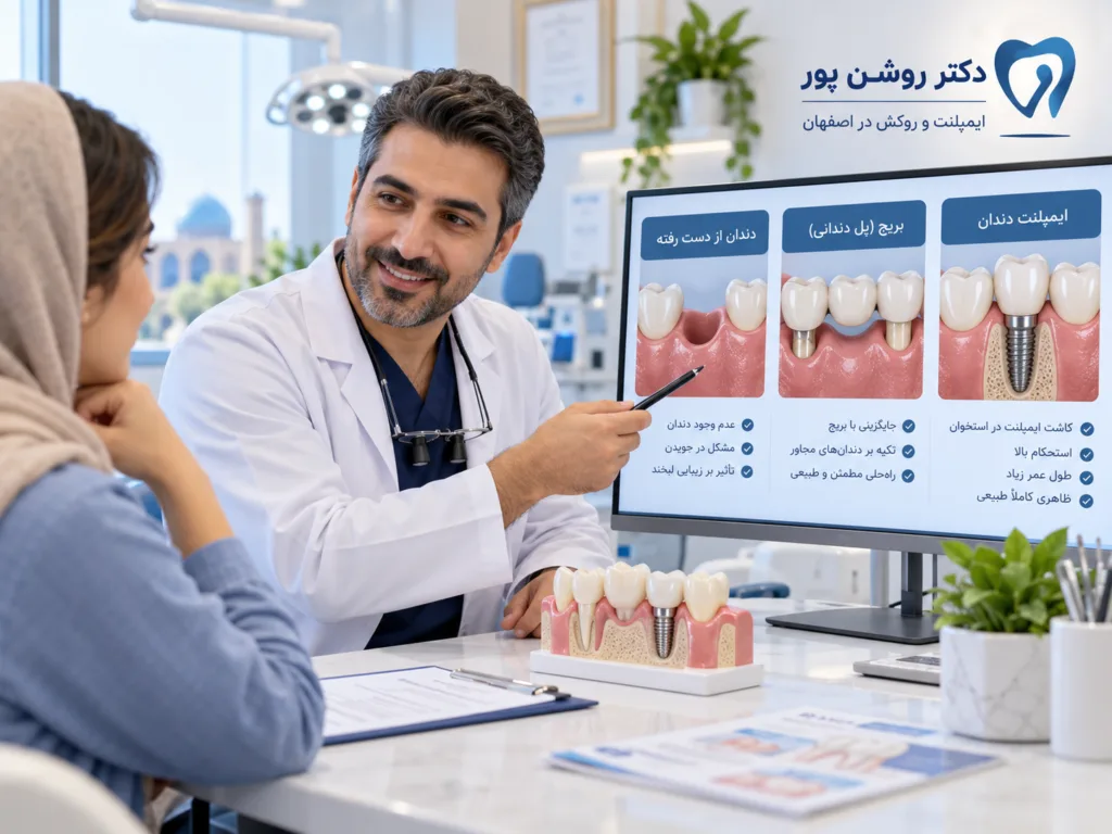 بریج یا ایمپلنت