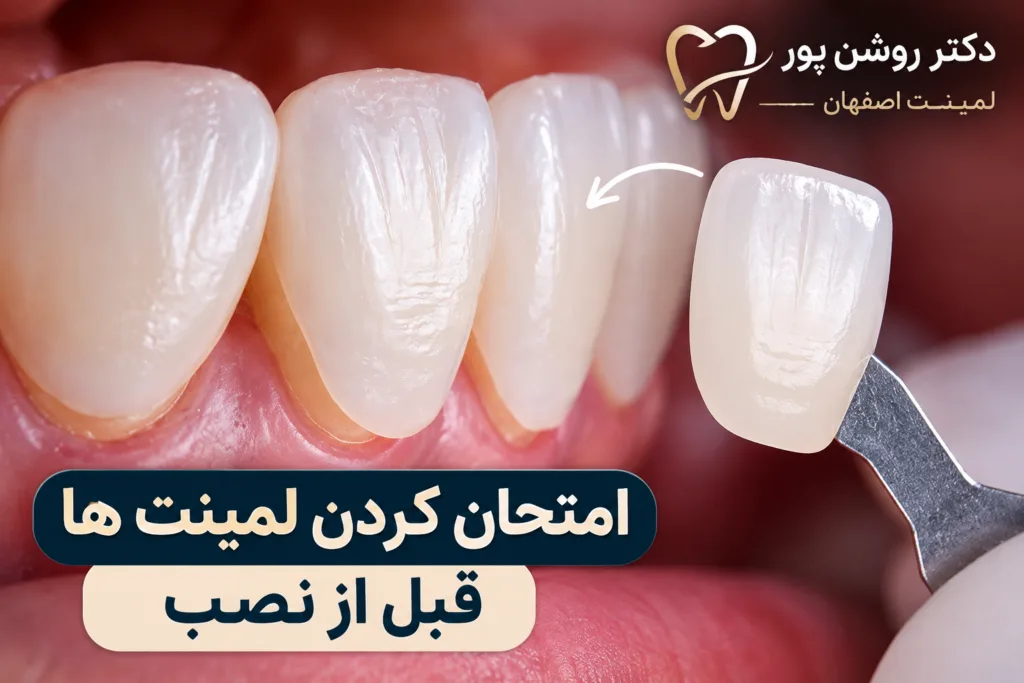 امتحان کردن لمینت ها قبل از نصب دکتر روشن پور اصفهان